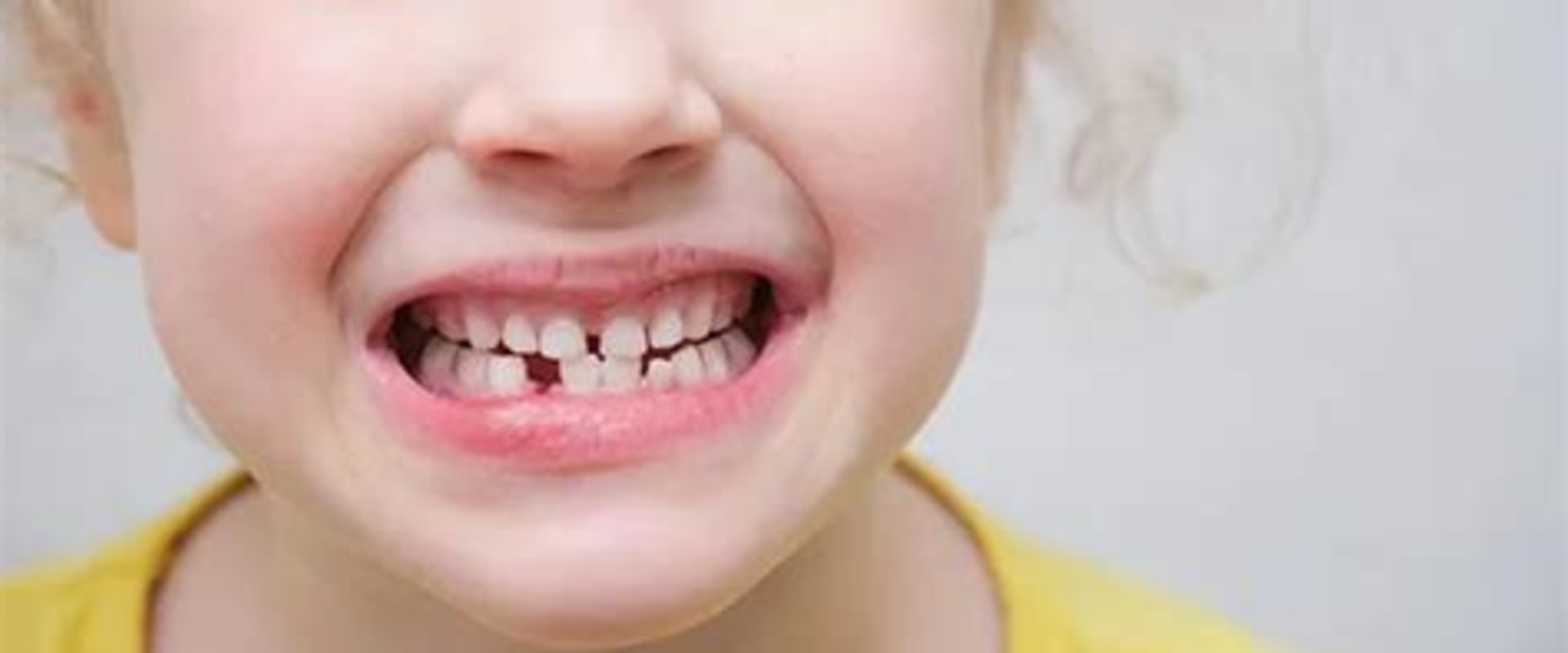 Understanding Teething Problems in Children