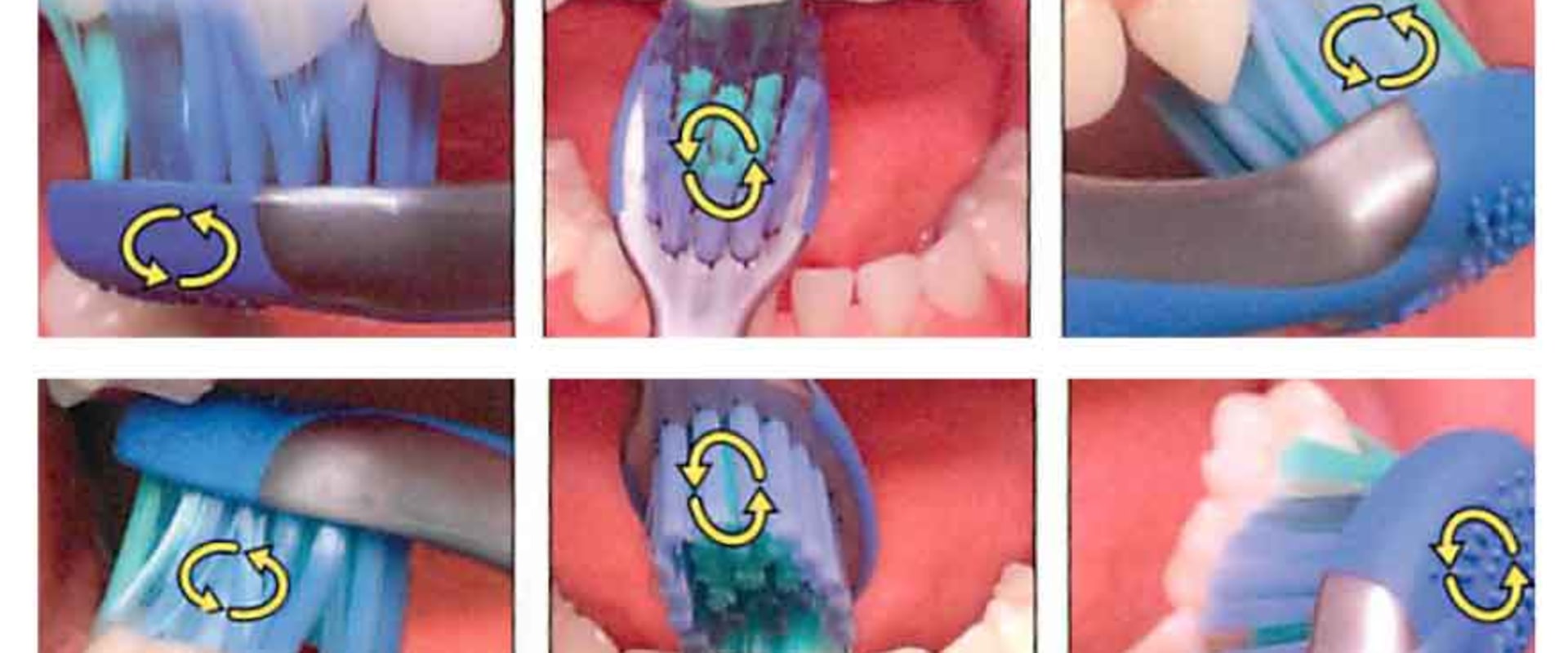 Essential Brushing Techniques for Kids