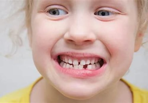 Understanding Teething Problems in Children